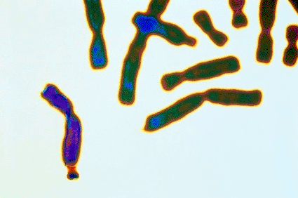 Image: Image: Light micrograph an X chromosome (purple) with fragile X syndrome, a genetic cause of mental retardation (Photo courtesy of CMSP).